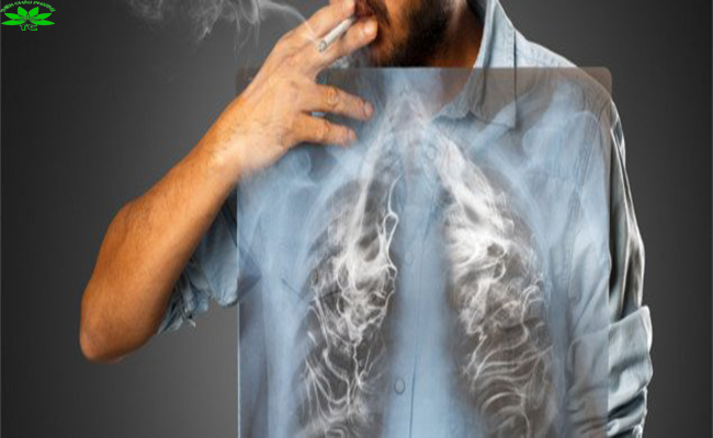 Tăng nguy cơ thoái hóa xương khớp vì hít khói thuốc lá thường xuyên